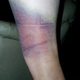 Illustration for article titled There Are So Many Ways To Make Your Leg Turn Purple